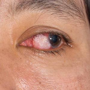 检查眼睛图片大全