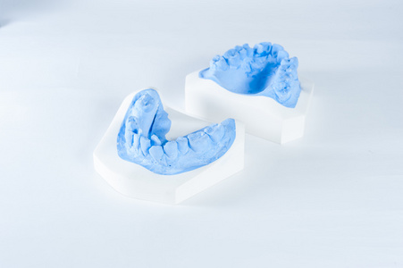 孤立的白色背景上的牙齿模型