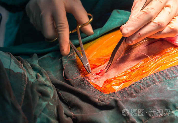 4043*2793px无水印下载免费10次/天下载小样发票合同问题/举报缝针医