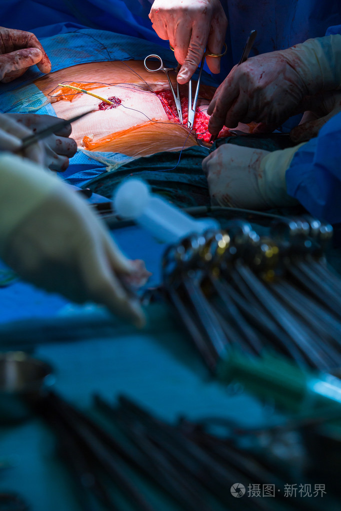 在现代医院的外科手术