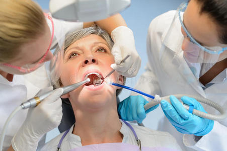 高级女病人牙科检查牙医团队