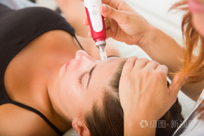 有吸引力的女病人接受电针在脸上