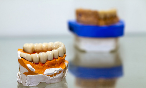 牙医存储区中的锆瓷齿板