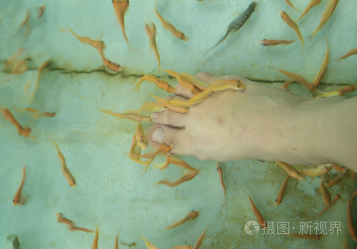 鱼水疗皮肤治疗