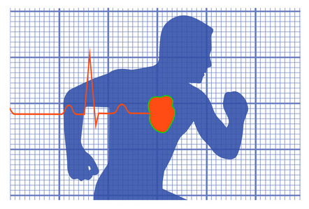 运行人象征心血管内科图片