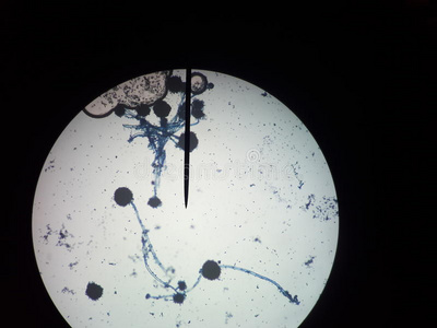 山苍子孢子图片