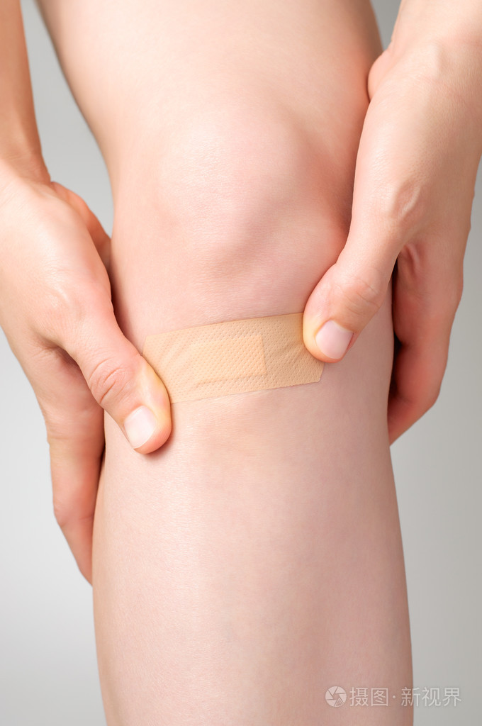 在女性的腿上石膏