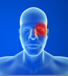 丛集性头痛照片