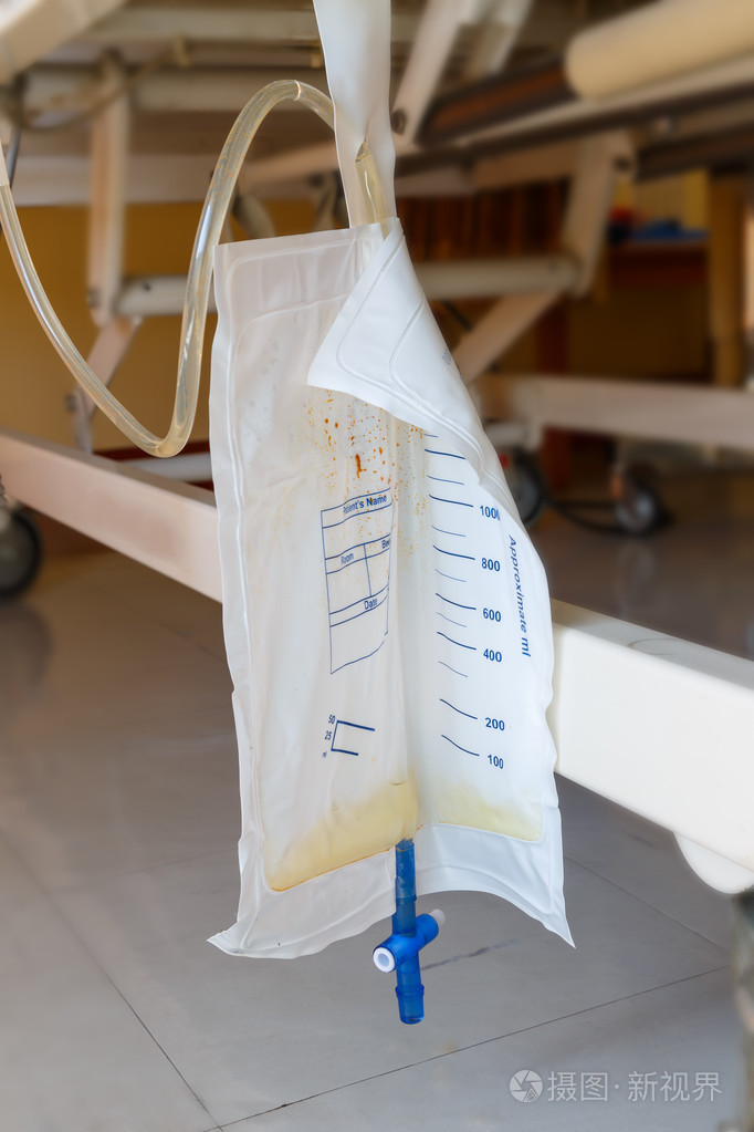 塑料尿袋挂在病人的床底下