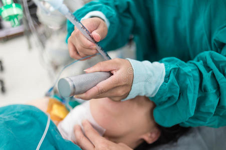 插入气管插管照片