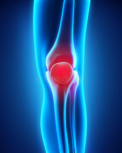膝盖疼痛插图