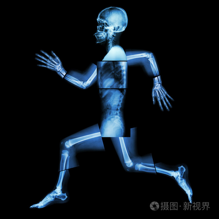 有氧运动人体骨骼正在运动全身x线他