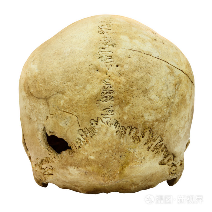 人类颅骨骨折背面蒙古人种亚洲孤立b上