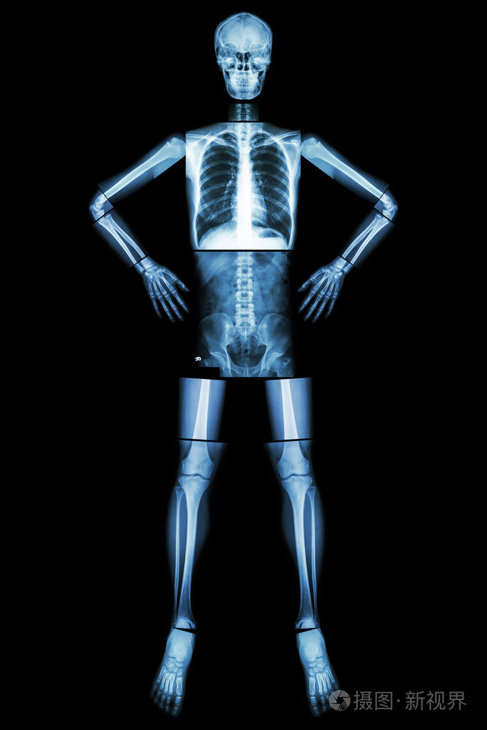 人体骨架和骨架x射线全身