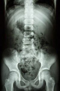 孩子的脊椎 腹部 骨盆 臀部