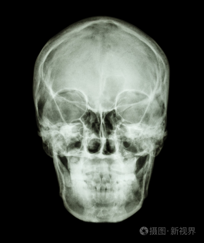 正常亚洲人类头骨泰国人