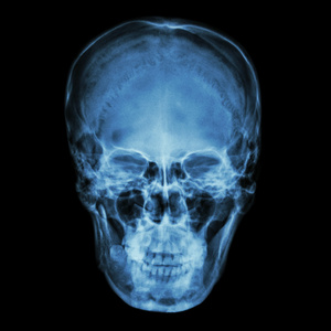X射线正常亚洲头骨泰国人