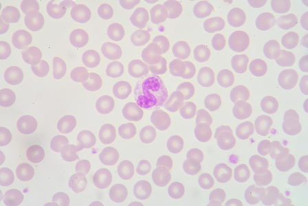 中性粒细胞照片