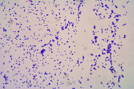 革兰氏阳性菌图片