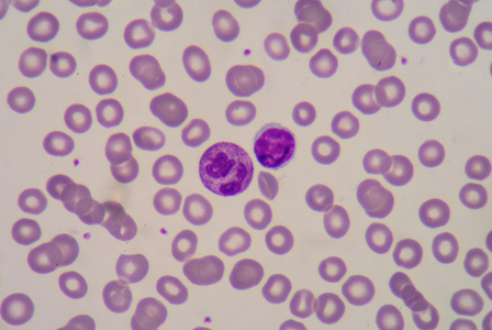 中性粒细胞和淋巴细胞照片