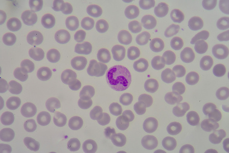 中性粒细胞照片