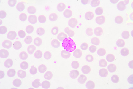 嗜碱性粒细胞图片-嗜碱性粒细胞素材-嗜碱性粒细胞插画-摄图新视界