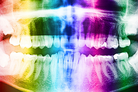 牙科 x 光的牙齿