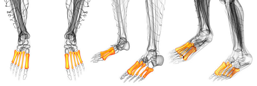 3d 渲染的跖骨的医学插图