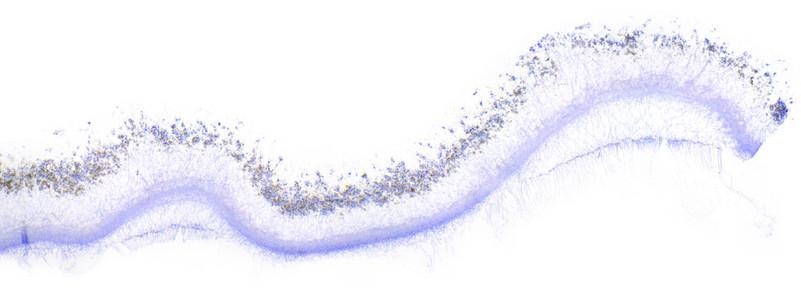 青霉素显微镜图片图片