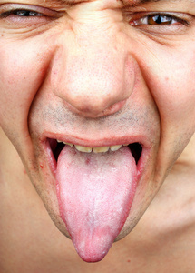感染的舌头