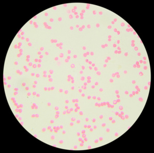 显微镜下的人体血液(血液涂片)照片