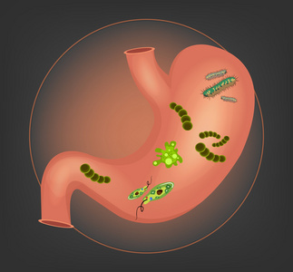 人类胃的细菌和微生物.矢量图照片