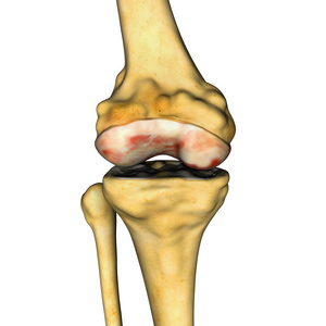 膝盖关节的解剖