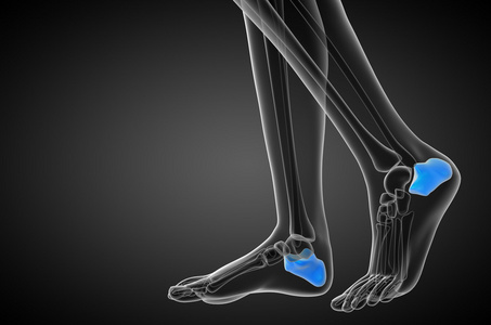 3d 渲染医学插图的跟骨的骨一张鞋跟的x光照片,女巫