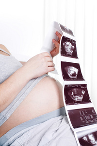 怀孕的女人观察超声