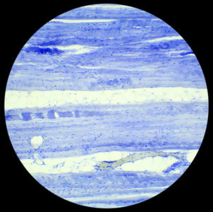 骨骼肌组织纵向切片在显微镜下照片