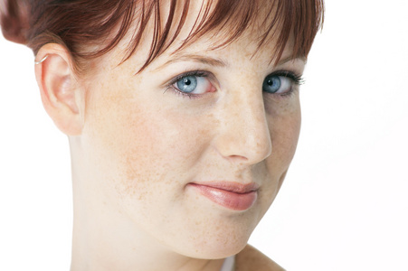 女性雀斑图片
