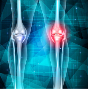 膝盖关节疼痛抽象三角背景