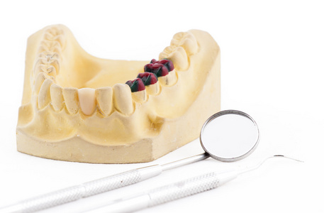 义齿铸造模型和牙科工具图片