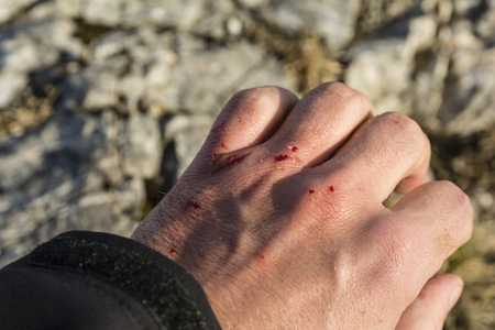 新鲜的伤口图片