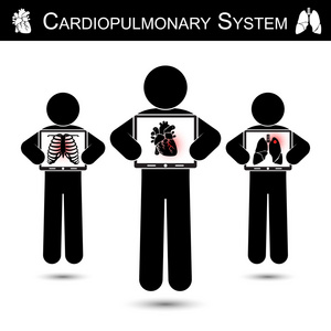 心肺系统。 人体保持监视器屏幕显示IMA