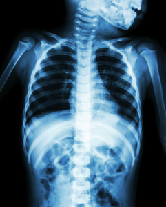 儿童胸部 x 光显示颈部 胸部 肩膀 手臂 腹部