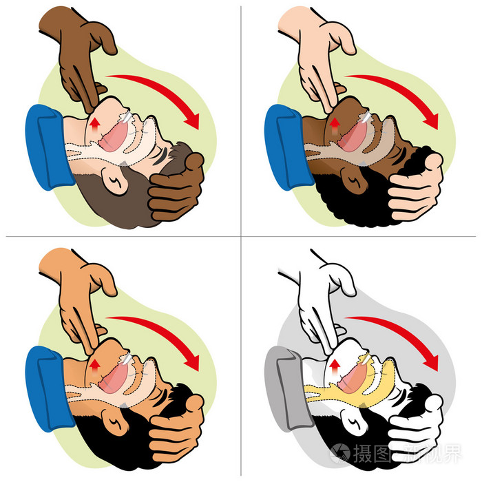 急救复苏 (cpr),清除呼吸, 定位, etnais.为复苏.