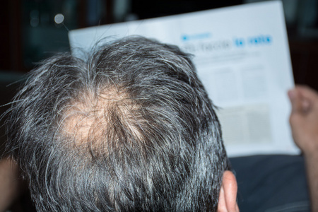 掉头发的男人图片