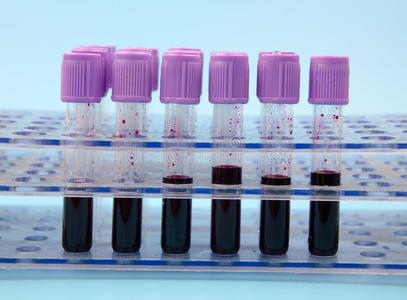 负压采血管图片