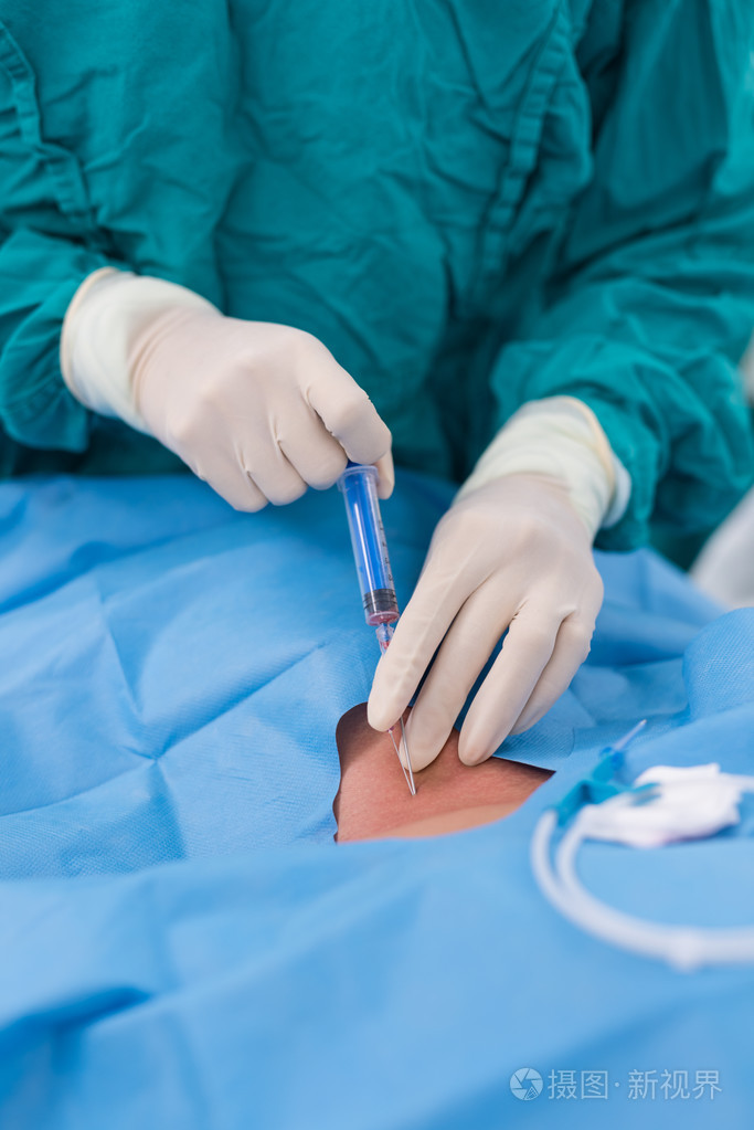 医生穿刺颈内静脉