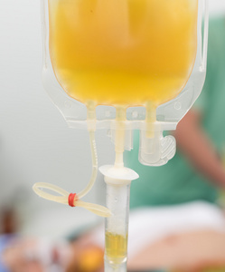 在手术过程中给新鲜冰冻的血浆成分血照片