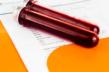 血液样本测试管与健康分析检查报告