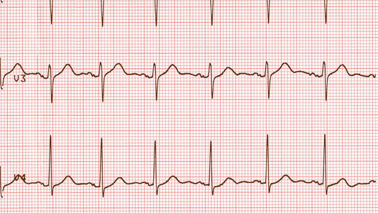 复古看心电图心脏的跳动图片