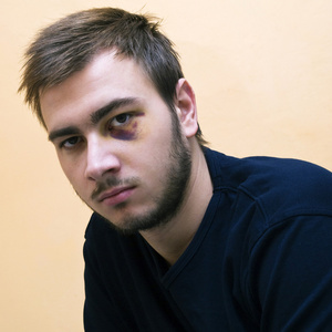 黑眼圈下面的唇上一名少年的下巴粉刺黑头的特写有问题的皮肤一名少年